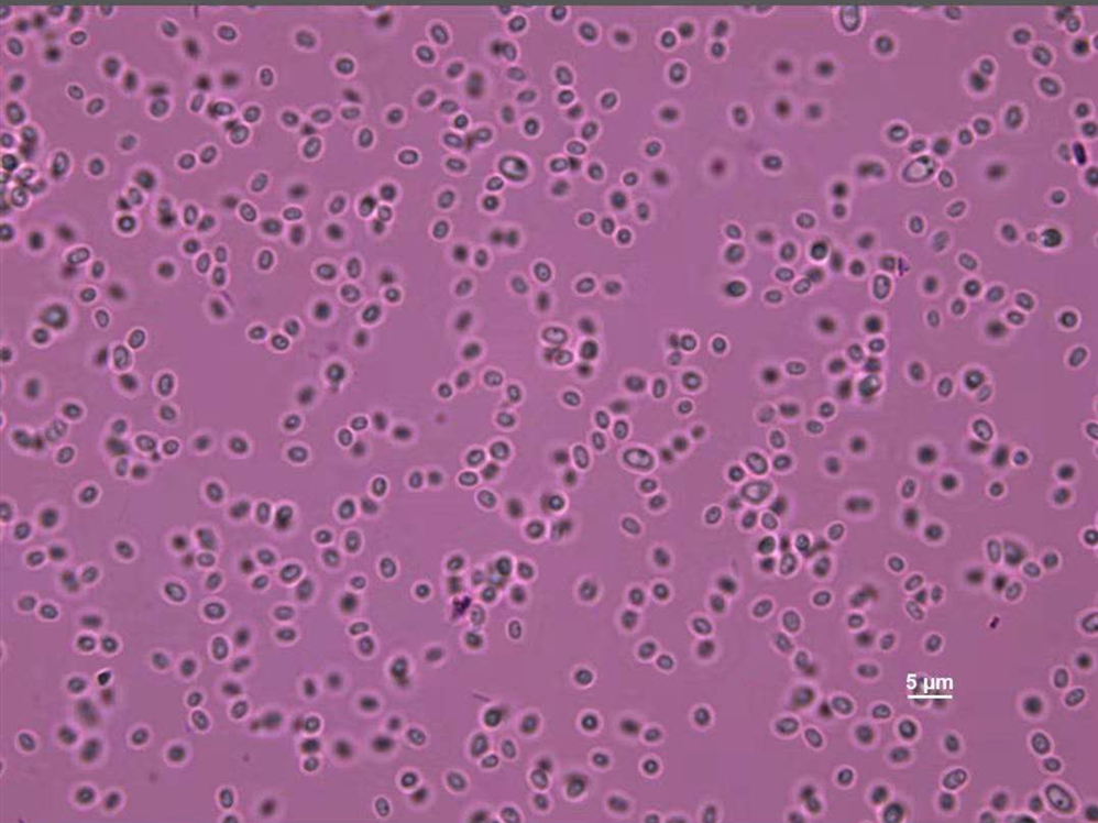 河蟹牛奶病電鏡下的病原體